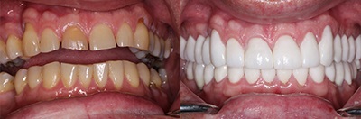 Southshore-Dental-Cosmetic-Dentistry-Trenton-1