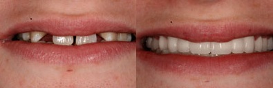 Southshore-Dental-Cosmetic-Dentistry-Trenton-14