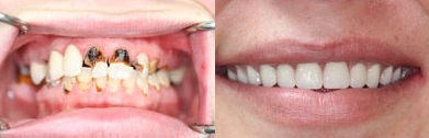Southshore-Dental-Cosmetic-Dentistry-Trenton-16 (1)