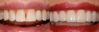 Southshore-Dental-Cosmetic-Dentistry-Trenton-17