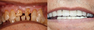 Southshore-Dental-Cosmetic-Dentistry-Trenton-18