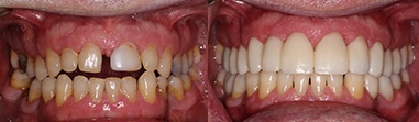 Southshore-Dental-Cosmetic-Dentistry-Trenton-2