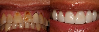 Southshore-Dental-Cosmetic-Dentistry-Trenton-23