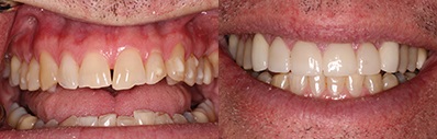 Southshore-Dental-Cosmetic-Dentistry-Trenton-3
