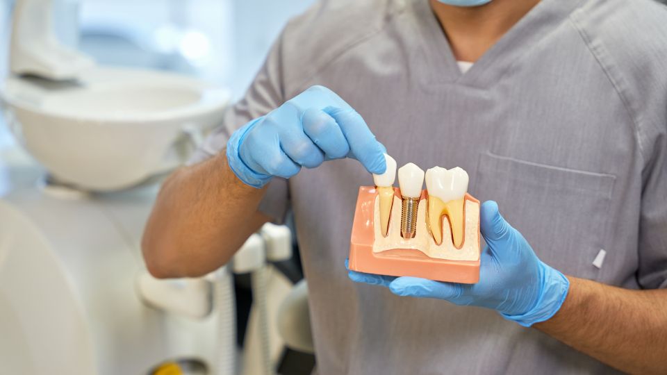 Common Questions Answered Regarding Dental Implants