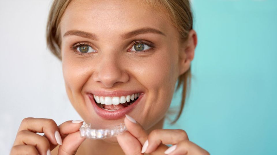 What It’s Really Like to Get Invisalign