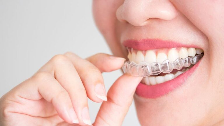 A Girl Wearing Invisalign