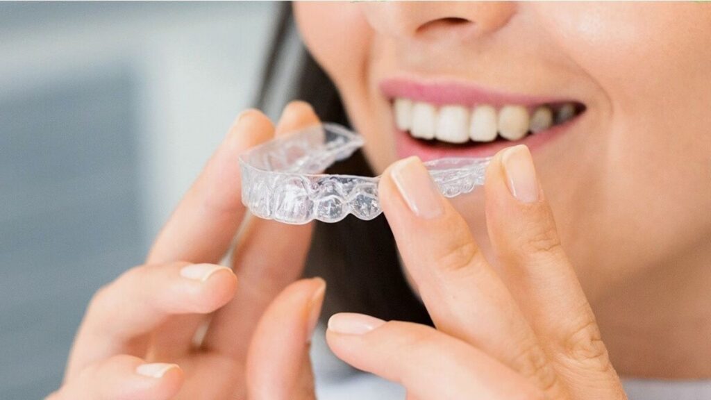 Person Inserting A Clear Dental Aligner Onto Their Teeth