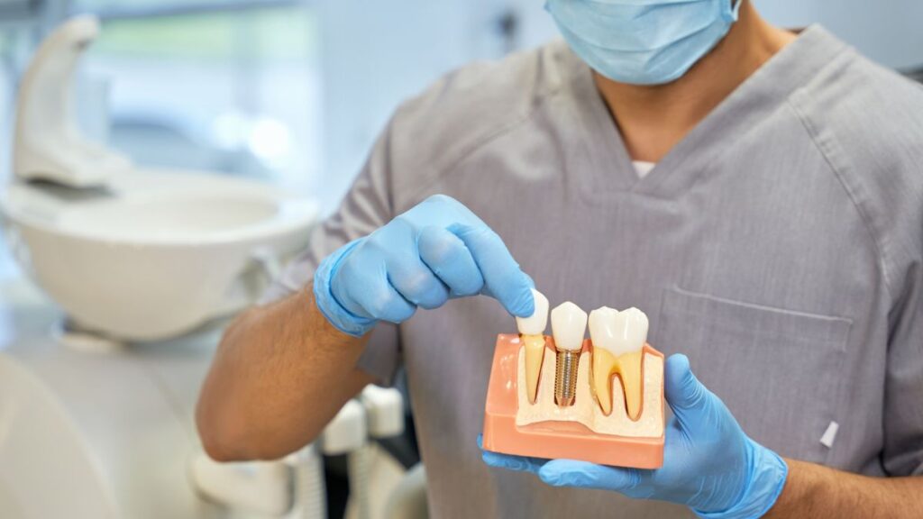 Dentist Showing Dental Implant Model