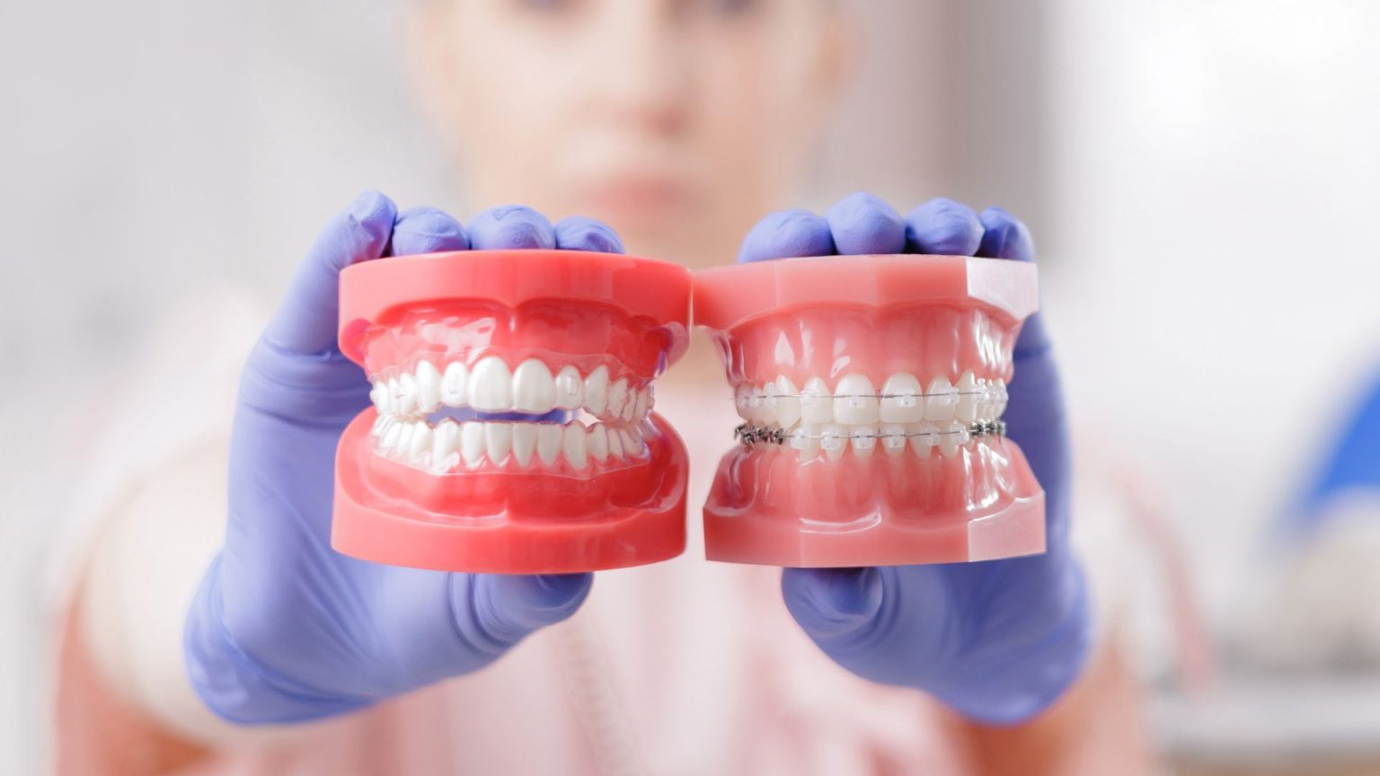 Dental Braces Demonstration Models