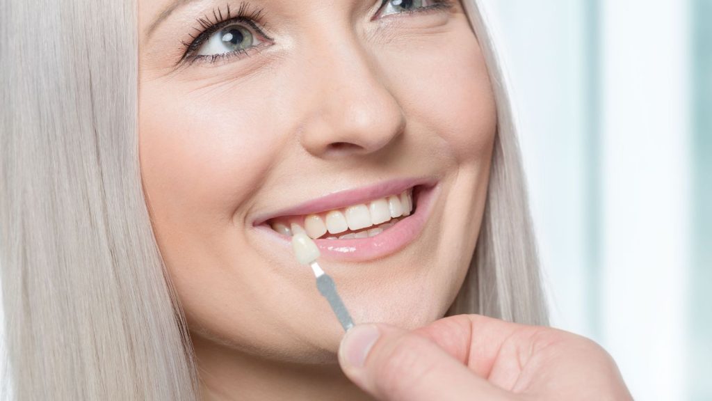 How We Ensure Veneers in Trenton Look Natural