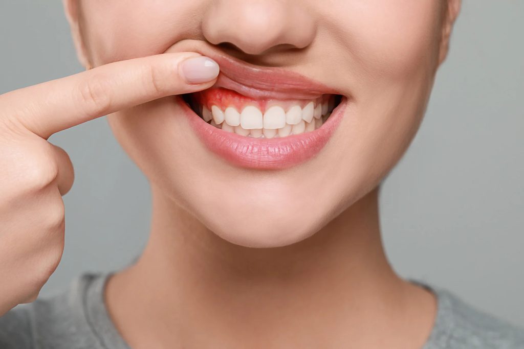 Person Showing Healthy Gums